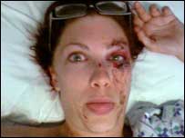 Lady with a broken face