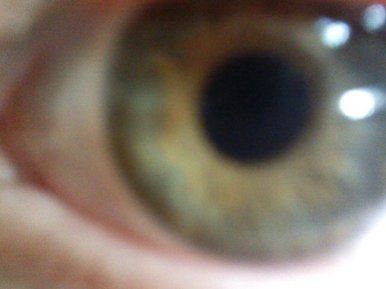 My eye