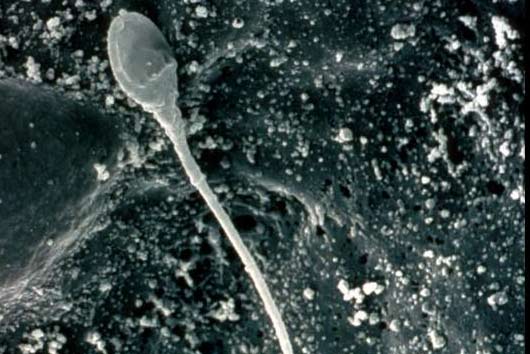 Sperm