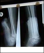 Arta's x-ray