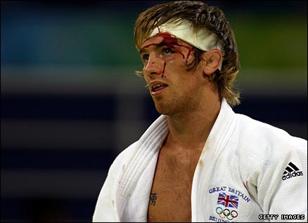 Medal hope Craig Fallon was left beaten and bloody in Beijing