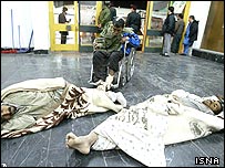 مجروحان زلزله بم