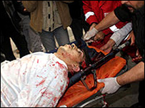 اسرائیلی حملوں میں زخمی فلسطینی