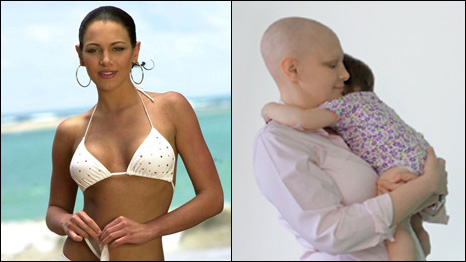 Eva Ekvall before and after the operation