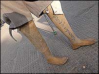 بارودی سرنگ کا شکار