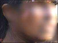 آنکھ کے بدلے آنکھ