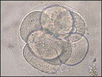 Vajíčko pod mikroskopem (ilustrační foto)