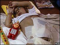 Felluce'de yaralı bir bebek