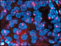 بافت لوزالمعده از موشی که با موفقيت درمان شد