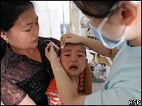 A young child receiving treatment after taking tainted milk powder