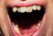 teeth