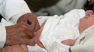circumcision