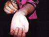 Self-harm