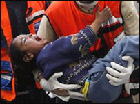 Bombardımanda yaralanan bir çocuk