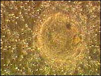 Espermatozóides em torno de óvulo