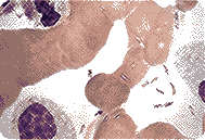 Bacteria linked with the Black Death epidemic