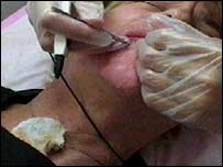 Donna having beauty treatment