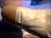 Liposlim device