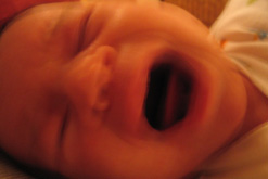 post natal depression