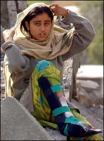 زخمی کشمیری لڑکی