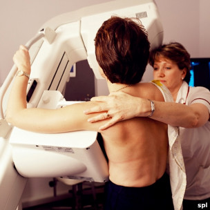 乳腺癌检查
