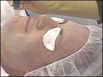 فردی برای جراحی به منظور کشيدن پوست آماده شده است