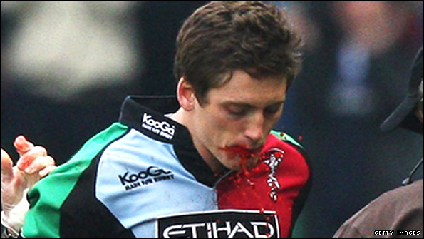 Harlequins' Tom Williams with fake blood 