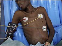 بيمار ايدز در داکار، سنگال