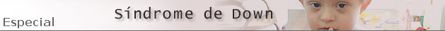 Síndrome de Down 
