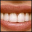 Sorriso