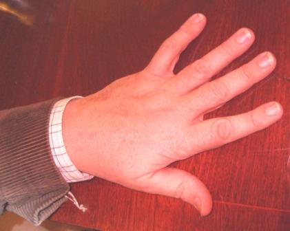 hand.JPG