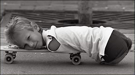 Nick Vujicic skateboarding as a child