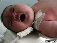Bebê gigante