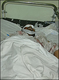 کوئٹہ فائرنگ