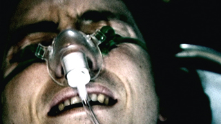 Human bird flu sufferer