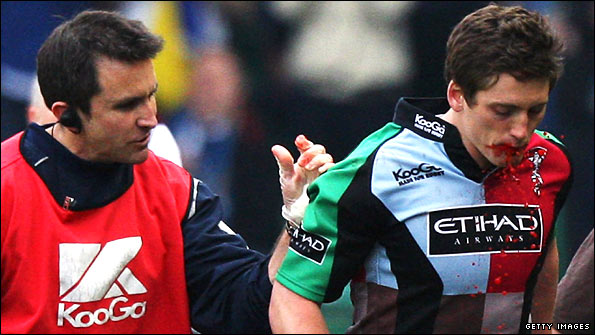 Tom Williams leaves the field with 