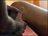 معاينه زانو