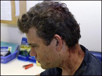 Ảnh chụp nhà báo Ben Stocking một vài giờ sau khi ở đồn cảnh sát