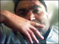 زخمی ڈرائیور