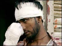 دھماکوں میں زخمی ہونے والے ایک شخص