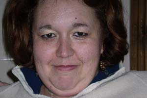 The turning point for Louise came when she discovered the Self Injury Support groupâ€¦having a counsellor who listened and offered advice was exactly what she needed.