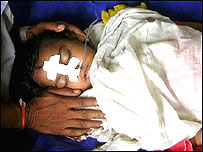 اس بیماری سے اترپردیش ریاست زیادہ متاثر رہی ہے