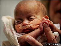 چھوٹی ترین بچی