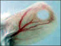 تولید رگهای خونی