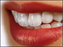 پوسيدگی دندان