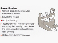 Severe bleeding advice from the British Red Cross