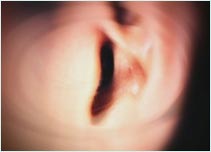 Ear which contains the balance organ