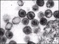 ويروس اچ آی وی